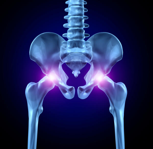 it-is-safe-to-drive-four-weeks-after-total-hip-replacement-surgery