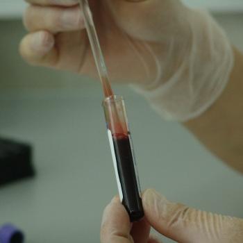 Blood sample