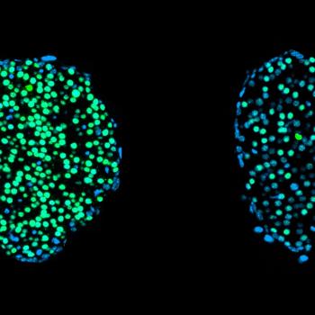 Fasting beta cells